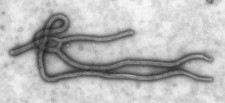 Ebola_Virus_TEM_PHIL_1832_lores
