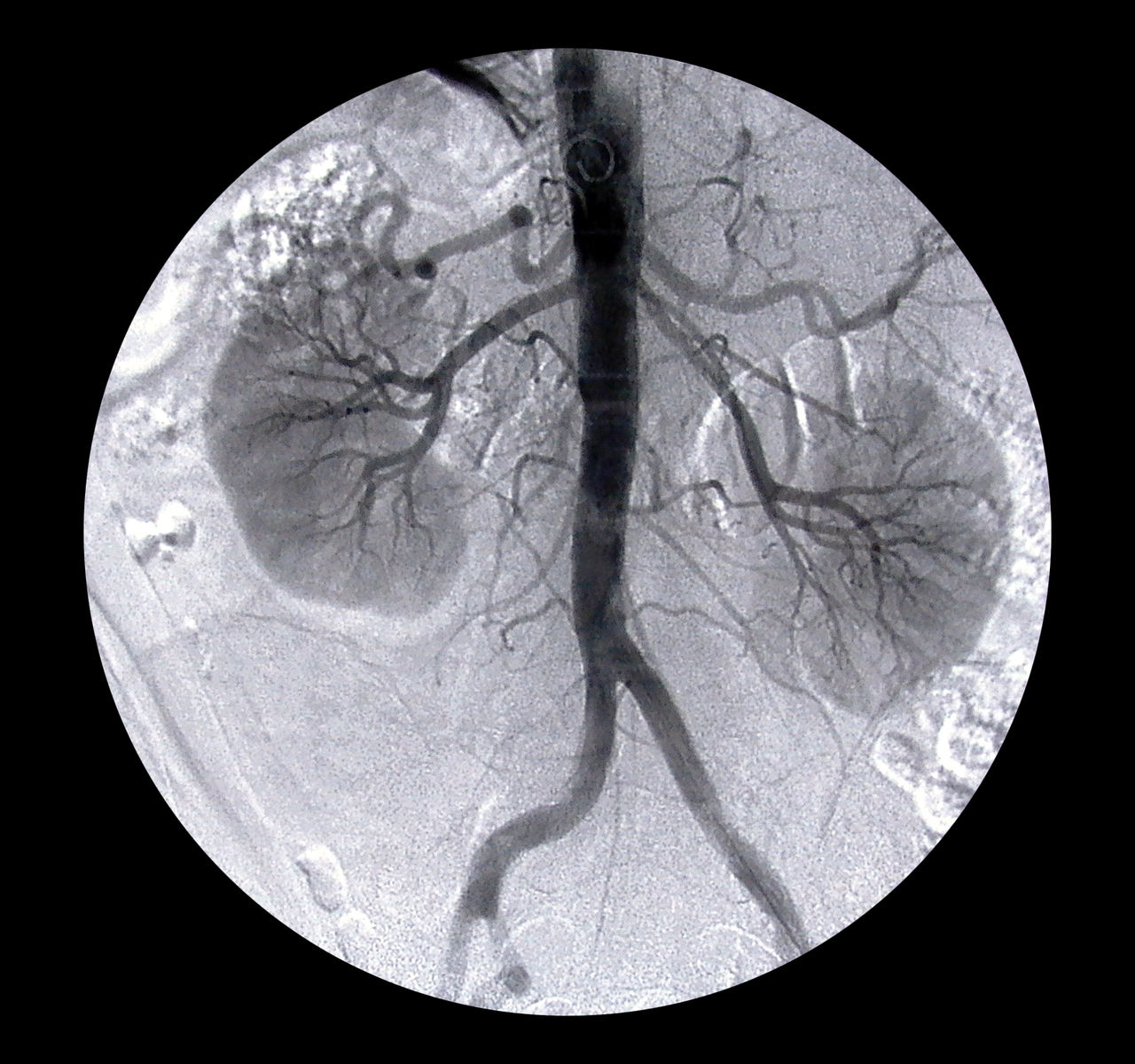 arteriography-1562063-1280x1200