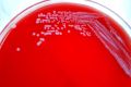 yersinia-pestis-bacteria-grown-in-petri-dish-on-a-medium-of-sheeps-blood-agar-120x80