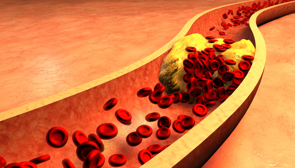 Cholesterol via Shutterstock
