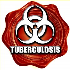 Tuberculosis via Shutterstock