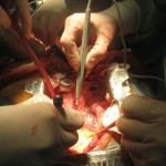 Transplant surgery via Shutterstock