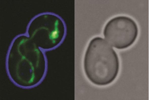 Fluorescence microscopy image of the mitochondrial network (left, in green) and the corresponding light microscopy image (right) of a dividing yeast cell. Images: Nils Wiedemann, University of Freiburg