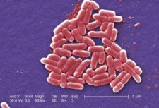 The mcr-1 plasmid-borne colistin resistance gene has been found primarily in Escherichia coli, pictured. REUTERS/Courtesy CDC