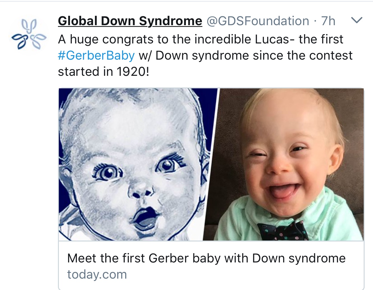 Gerber's New Spokesbaby Has Down Syndrome. And It's About Time ...